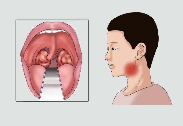 老年人简单患病怎么办？5个自我维护应对方法